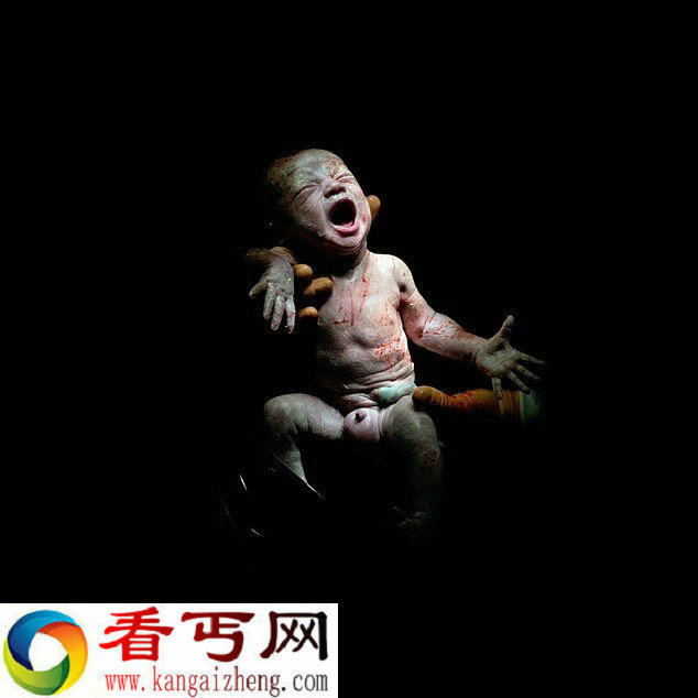 法国摄影师拍摄剖腹产婴儿出生的18秒瞬间
