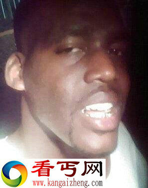 恐怖！电子烟在男子嘴中爆炸了