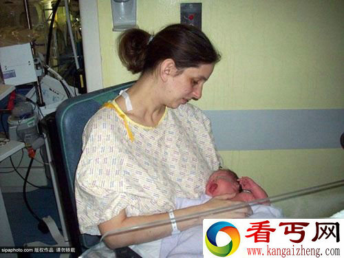 女孩患怪病舌头不能停止加速生长
