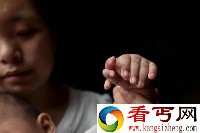 男婴患罕见多指症 天生长出了31个手指、脚趾头