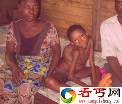 印度男孩双脚不停地生长 村民把他当成妖灵转世