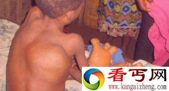 印度男孩双脚不停地生长 村民把他当成妖灵转世