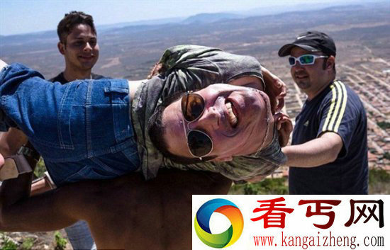 太吓人! 巴西男子头部居然朝下生长