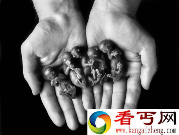 母狗生下人形怪孩 人类器官和四肢都齐全