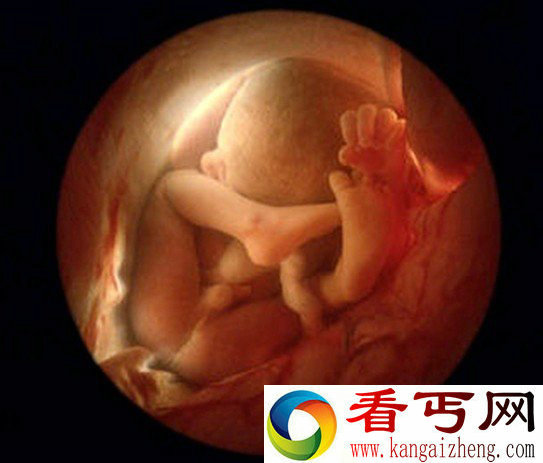母狗生下人形怪孩 人类器官和四肢都齐全