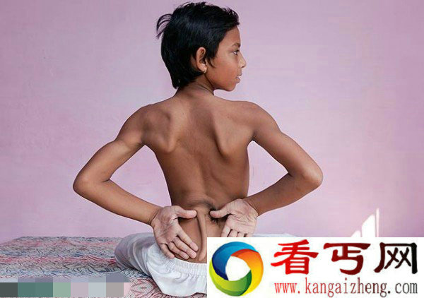 印度一男孩长着神奇尾巴 在当地被奉为神灵信徒朝拜
