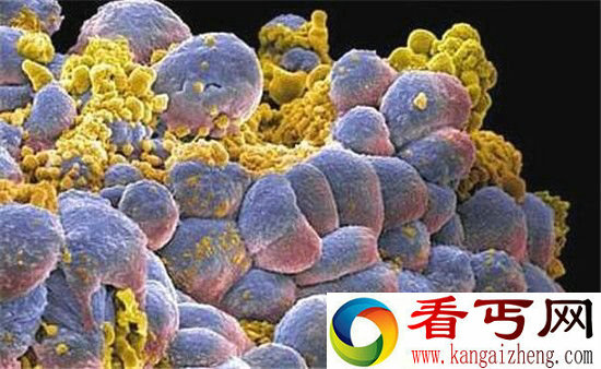 科学家发现治疗癌症新方法 副作用极小