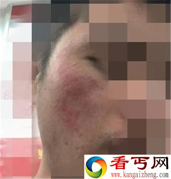 多名大学生毁容 参加丧尸跑活动被商家坑惨