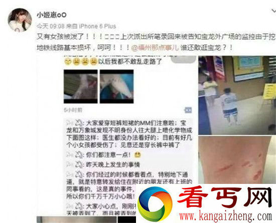 多名穿短裙女孩遭泼不明液体!腿部被灼伤