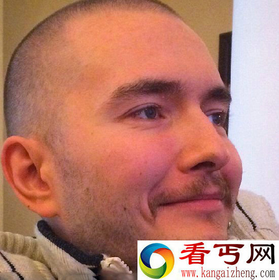 俄罗斯电脑工程师 成第一个更换头颅的人