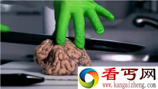 银行除了存钱还能存脑子 你要看一看切片的脑子吗