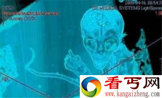 外星人绝密档案曝光 墨西哥发现外星人宝宝