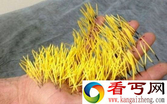 不明生物一掌拍下 手掌莫名遭殃