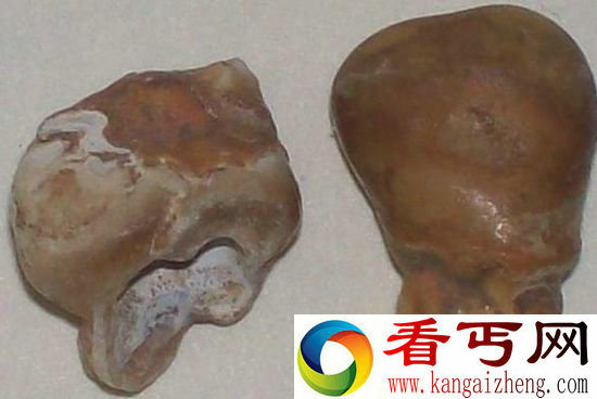 中国现17.8万年前牙齿化石 证明人类起源