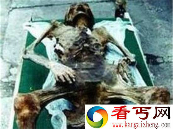千年女尸产下七公斤活婴 震惊世界!