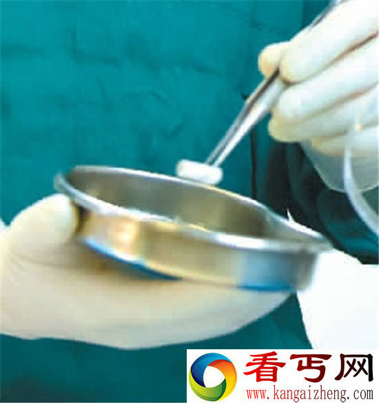 3D打印人工血管 还实现了与原有血管在体内的完美结合?