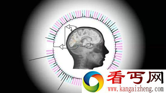 美国科学家研制奇特读脑设备帮助中风与脑瘫患者进行表达