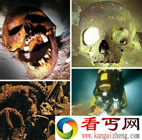 人类遗骸