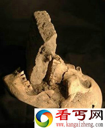 古尸口含砖头