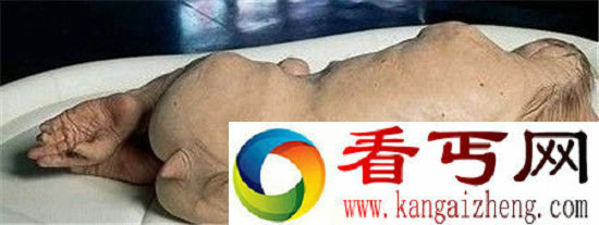 世上竟有人与猪杂交的怪物