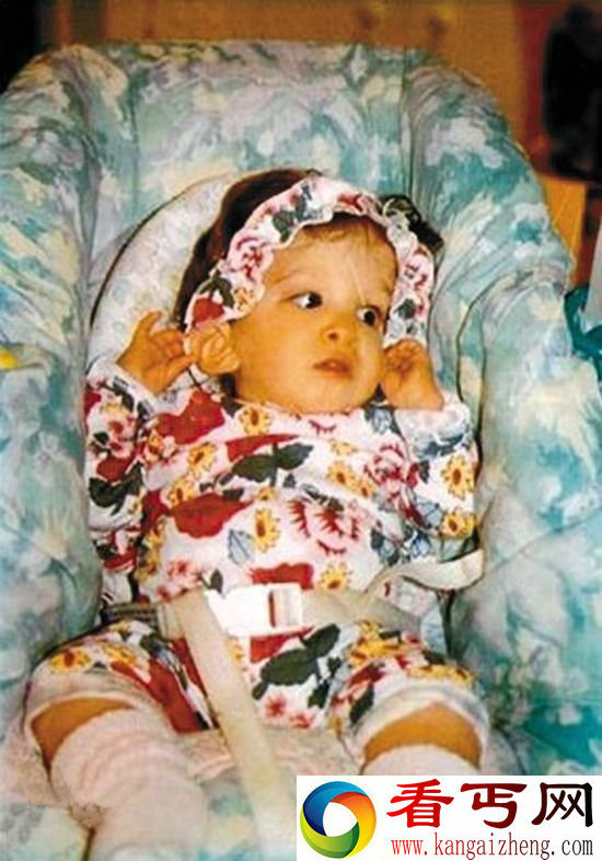 不老女婴 二十岁一如既往是童年