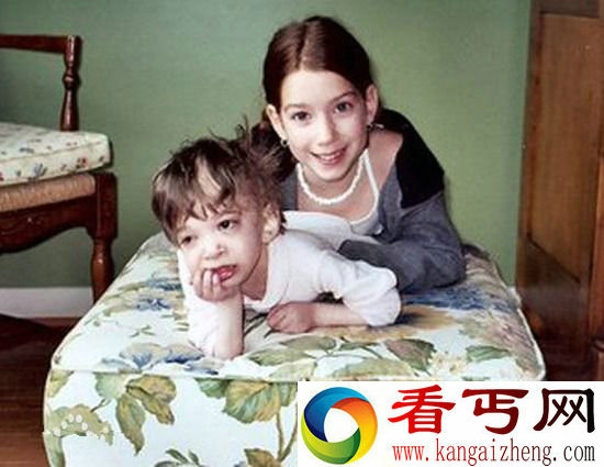 不老女婴 二十岁一如既往是童年