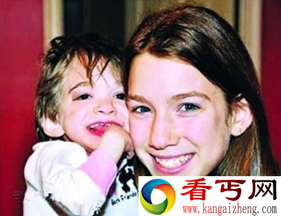 不老女婴 二十岁一如既往是童年