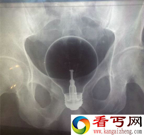 人的下体