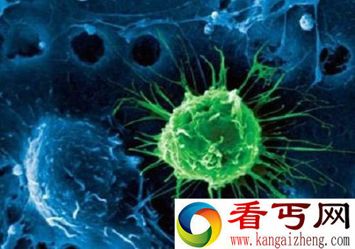 形态特殊的外星人?巴西发现超级抗辐射生物