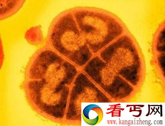 形态特殊的外星人?巴西发现超级抗辐射生物