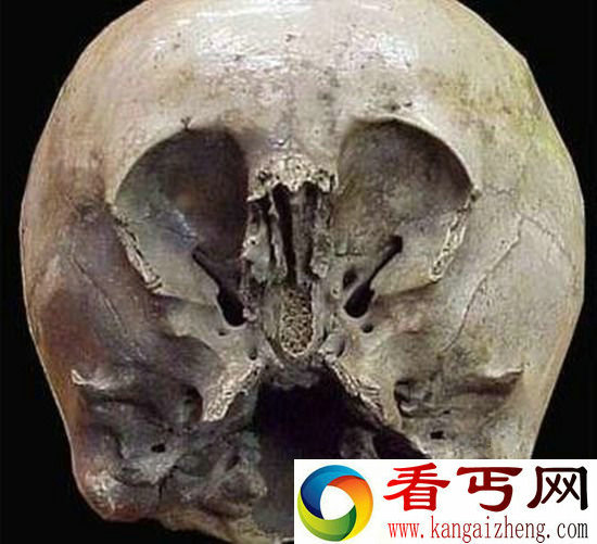 墨西哥奇怪头骨之谜 是外星人还是其他物种？