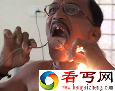 身体过电而不死之人