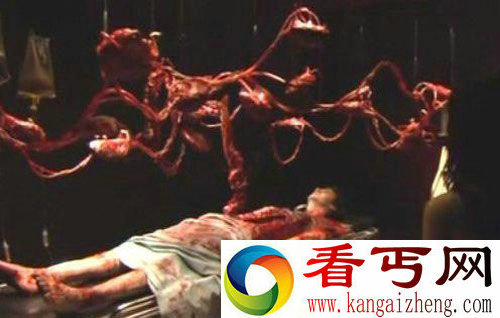 特异功能 女尸 医生 复活 解剖