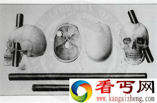 世界十大起死回生事件 老天爷都杀不死!
