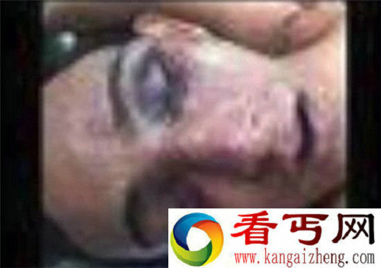 新苹果手机惊现女子被虐恐怖照片 无法删除
