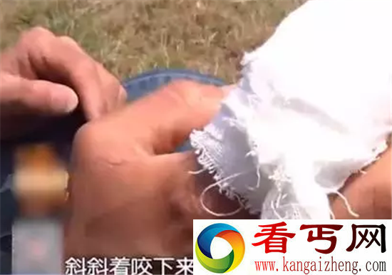 男子动物园喂熊被咬掉手指