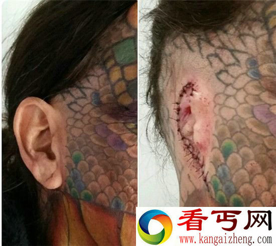 男子中年男子整容为龙女 变性割耳纹满鳞片