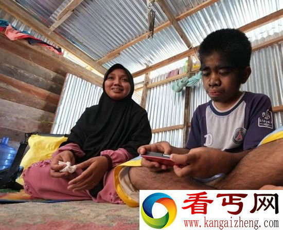 印尼狼孩自认被神选中 拒绝接受治疗