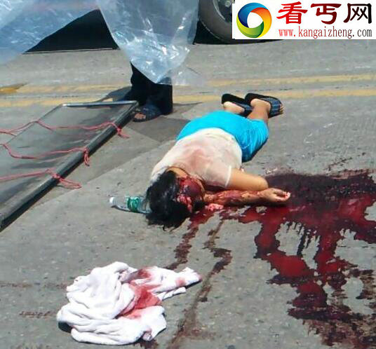 实拍车祸图片大全,各种血腥凄惨的车祸图片