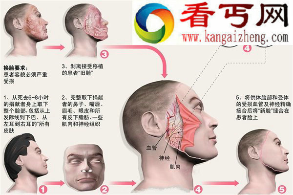 换脸是种什么感觉 恐怖的脸部移植手术