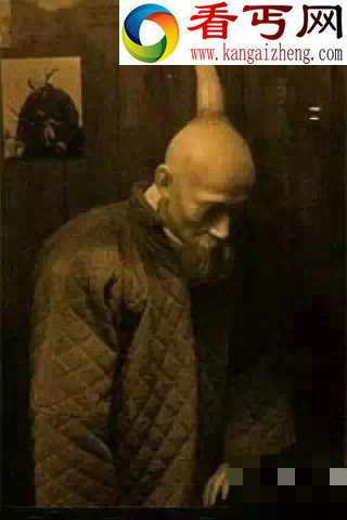 骇人听闻的真实照片 三条腿的人 长尾巴的人