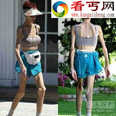2016最震撼人体奇闻 男子怀孕女人4条腿