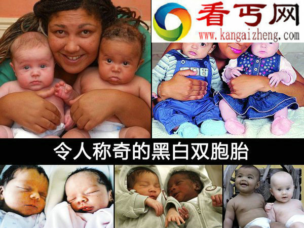 神秘的双胞胎传奇（多图）