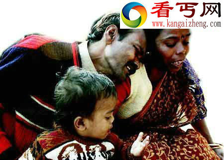 15大史上最恐怖的心理疾病(多图)