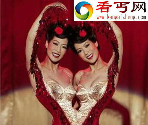 两人一个身体的恐怖变异连体人（组图）