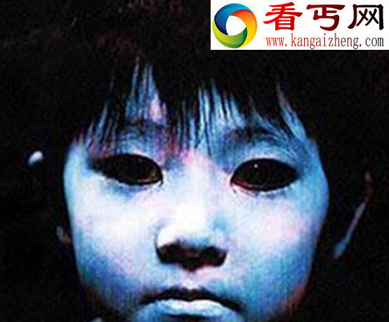 神秘的阴阳眼是真的吗，阴阳眼疑为精神分裂症