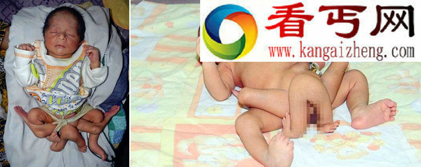 不可思议奇异罕见怪病