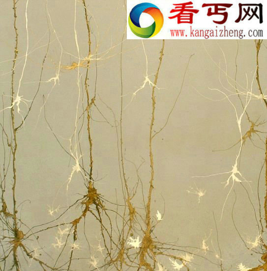 这张绘画显示的是靠近大脑皮层的地方,大脑皮层是一层组织,它被认为在人类感知方面起着至关重要的作用 (图)美研究人员用人类大脑神经元创作水墨画