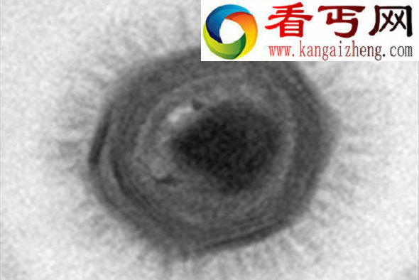 智利海域发现世界最大病毒拥有1000多个基因