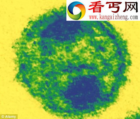 显微镜下看到的艾滋病毒研发这种疫苗的下一步工作是进行人类临床试验。 美国研制艾滋病疫苗 有望终生控制病毒感染